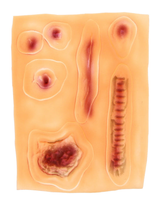 Halloween Scabs